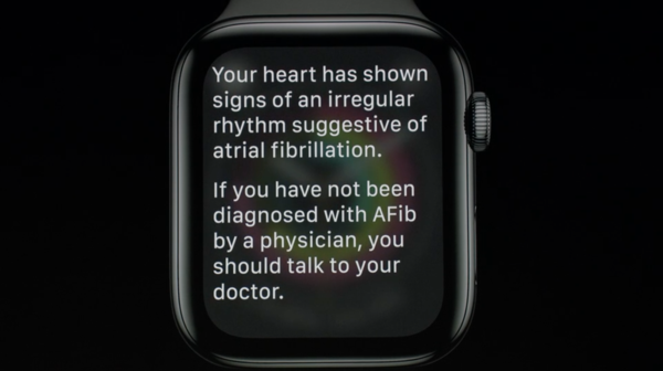 Apple Watch Series 4 osaa huomauttaa sydämen epätavallisesta toiminnasta.